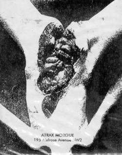 Atrax Morgue : 195 Melrose Avenue NW2